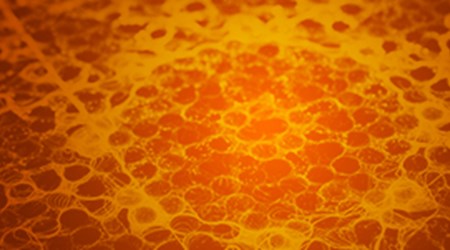 Case Stories Resource Thumb 9